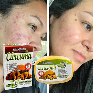 🚨EL MEJOR JABON DE CURCUMA 3 EN 1🚨(CASI AGOTADO)🚨.