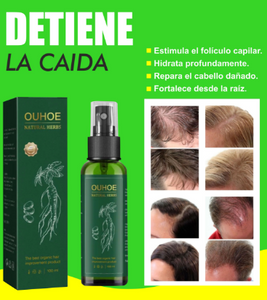 ✅OUHOE✅ POTENTE ELIXIR DE CABELLO👌(CASI AGOTADO)😱