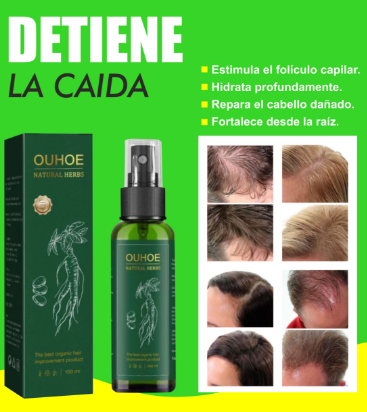 ✅OUHOE✅ POTENTE ELIXIR DE CABELLO👌(CASI AGOTADO)😱